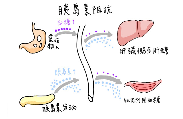 胰島素阻抗,代謝作用,胰島素代謝作用