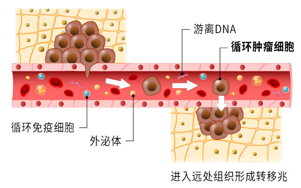 循环肿瘤细胞,CTC,癌细胞转移